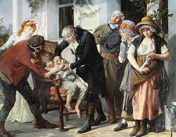 Edward Jenner (1749-1823) performing the first vaccination against Smallpox in 1796 1879