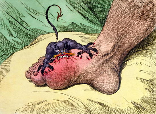 The Gout, published by Hannah Humphrey in 1799 (hand-coloured softdground etching) von James Gillray