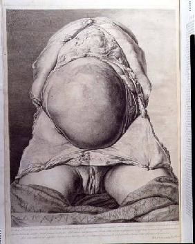 Anatomical drawing of the abdomen of a pregnant female human with skin peeled back pub. 1774