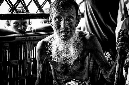 Rohingya-Flüchtling älterer Mann – Bangladesch