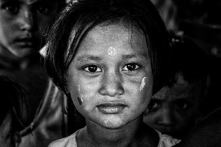 Rohingya-Flüchtlingsmädchen – Bangladesch