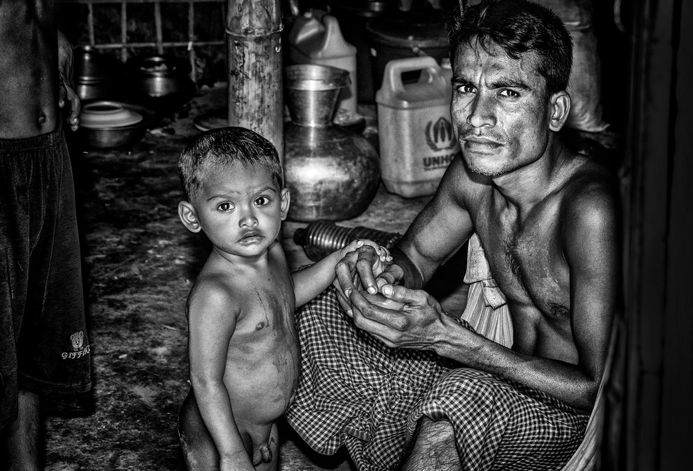 Rohingya-Flüchtlingsvater und sein Sohn – Bangladesch von Joxe Inazio Kuesta Garmendia